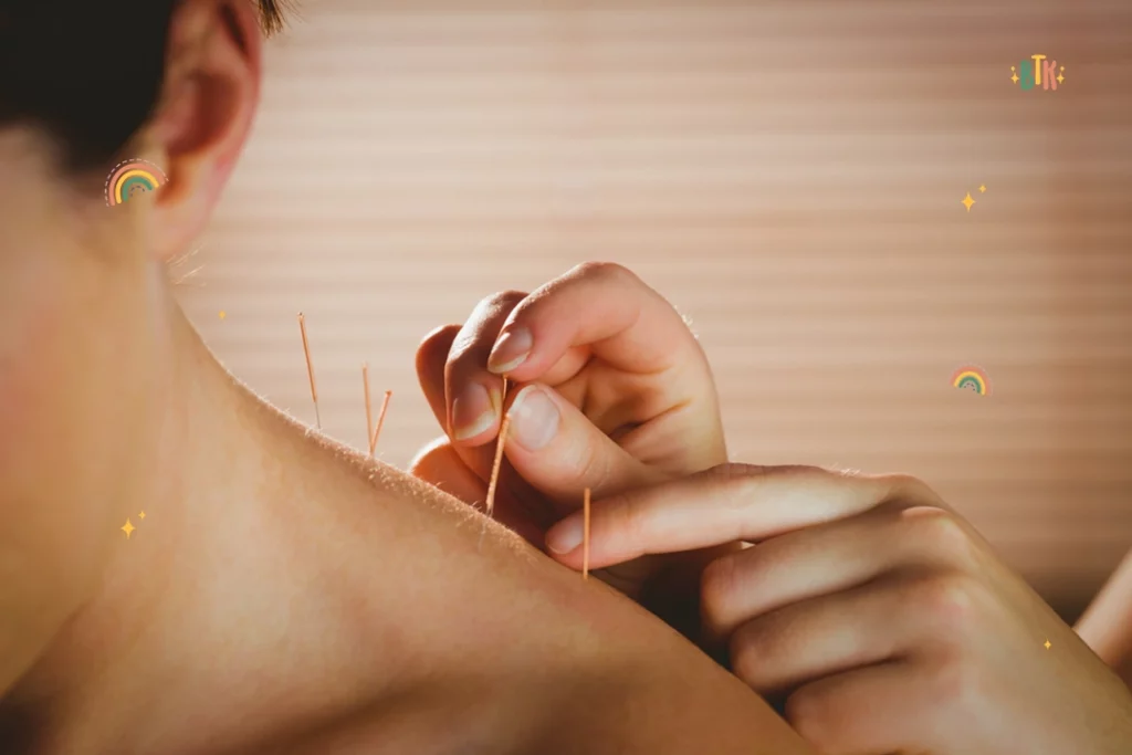 What are the benefits of pregnancy acupuncture